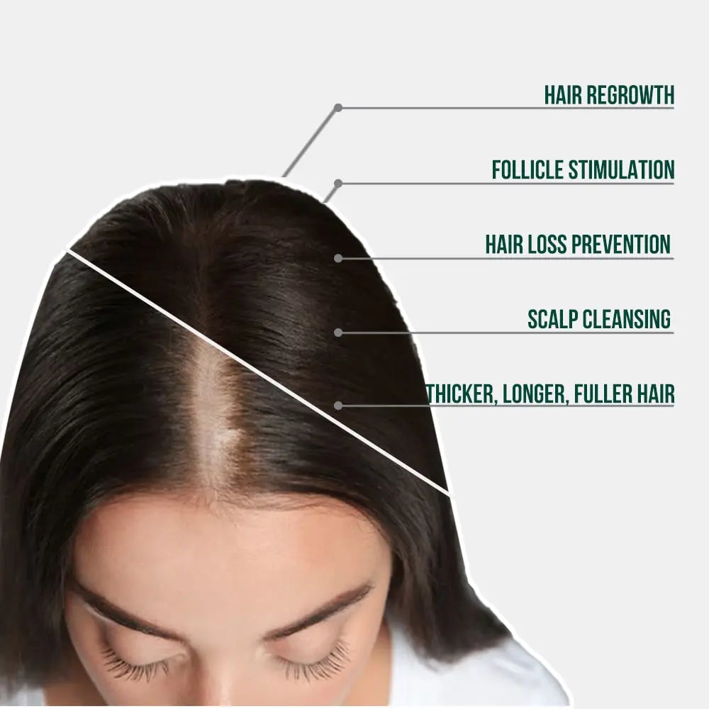HAIR RESTORATION SYSTEM